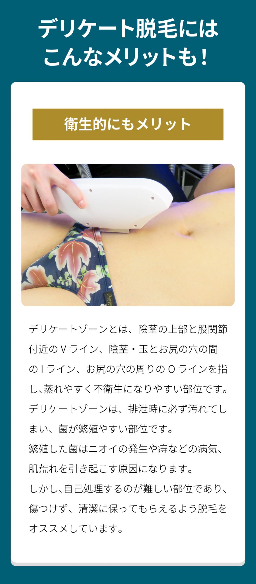 デリケート脱毛にはこんなメリットも 衛生的にもメリット デリケートゾーンとは、陰茎の上部と股関節付近のVライン、陰茎・玉とお尻の穴の間のIライン、お尻の穴の周りのOラインを指し、蒸れやすく不衛生になりやすい部位です。
デリケートゾーンは、排泄時に必ず汚れてしまい、菌が繁殖やすい部位です。
繁殖した菌はニオイの発生や痔などの病気、肌荒れを引き起こす原因になります。
しかし、自己処理するのが難しい部位であり、傷つけず、清潔に保ってもらえるよう脱毛をオススメしています。